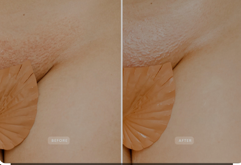 Brazilian Wax with Vajacial