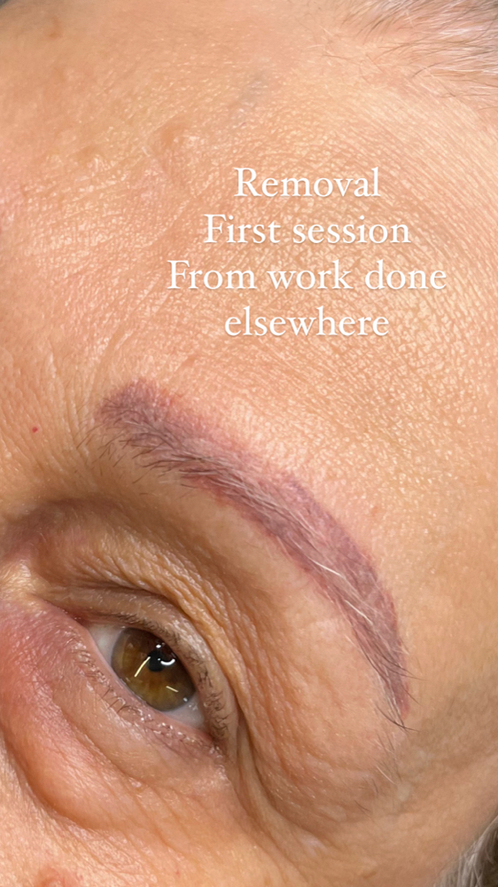 Saline Removal/Lightening
