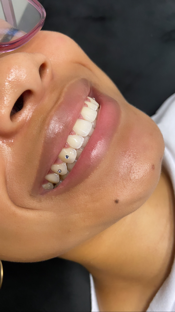 Tooth Gem