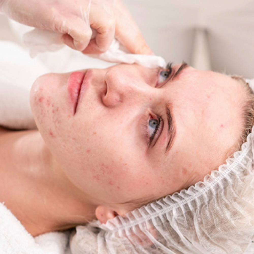 Clarifying Acne Facial at BEAUTY SPOT in Jacksonville, FL