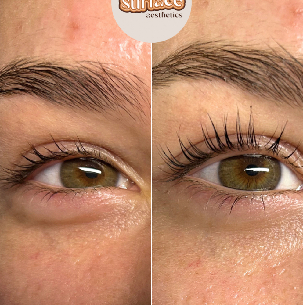 Lash Lift + Tint at Surface Aesthetics in Jackson, GA