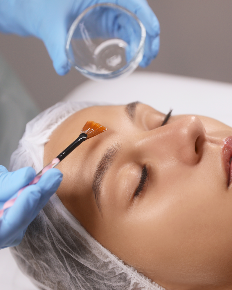 Brightening Peel