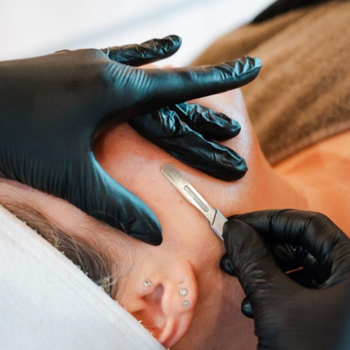 Dermaplane Add-On at Saige Esthetics in Eagle, ID