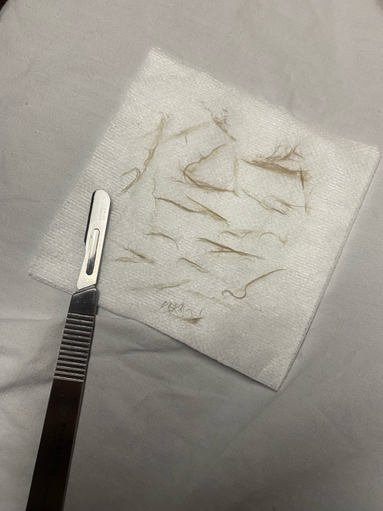 Express Dermaplane
