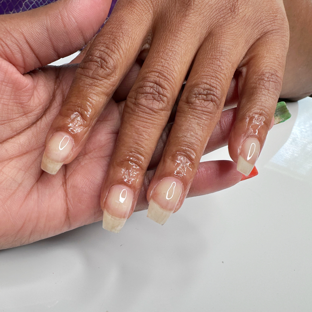 Natural Overlay