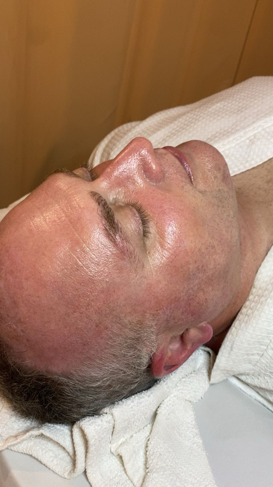 Beautifully Bald Facial