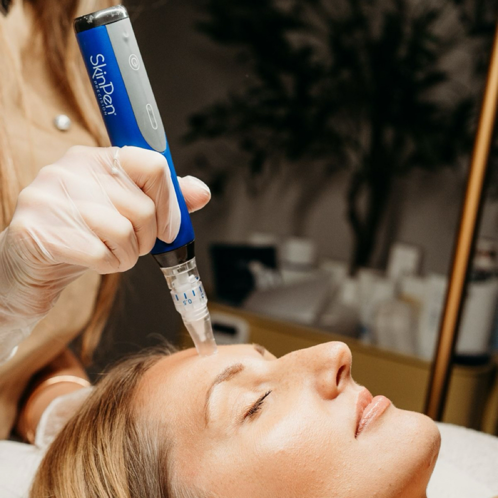 Skinpen Microneedling Face Only at Anfissa Beauty in Mount Angel, OR