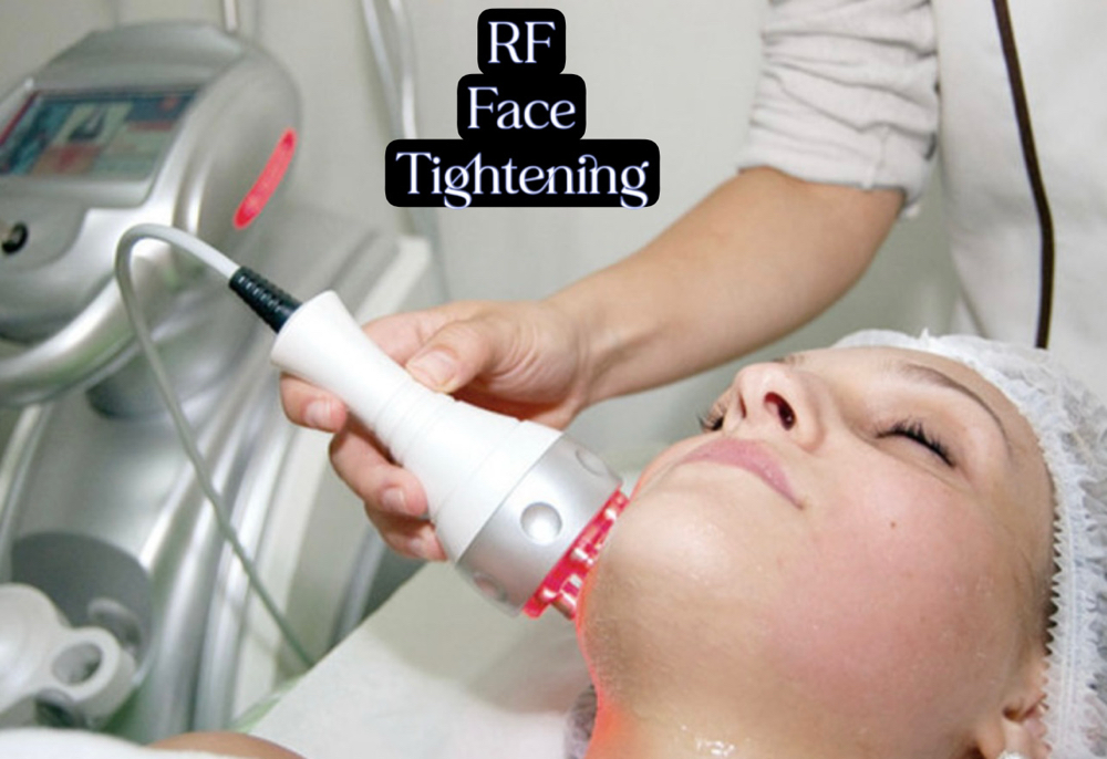 (3 Sessions) RF Facials