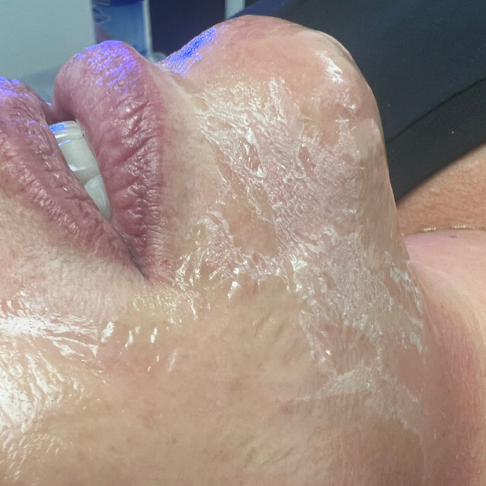 V-Tox Facial at Plush Spa in Joplin, MO