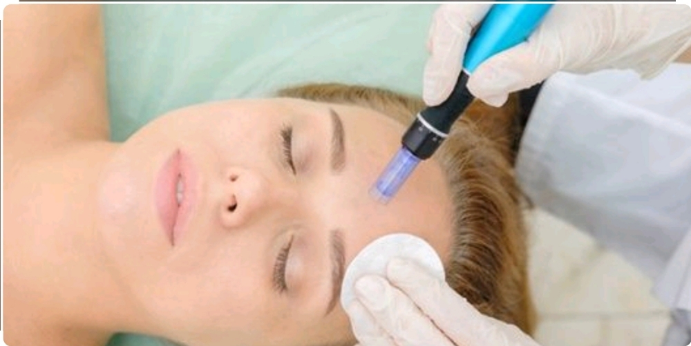 Anti-Aging Microneedle Treatment