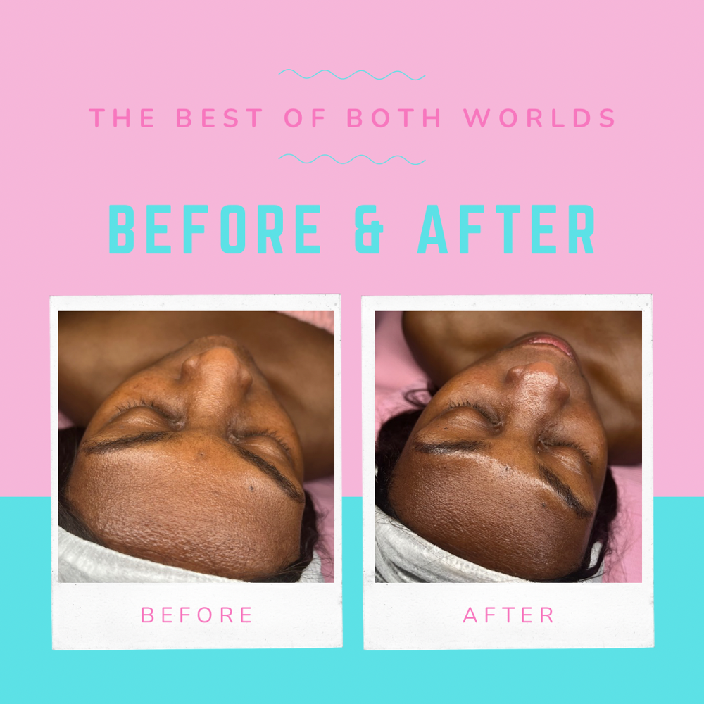 Deep Pore Cleanse Facial