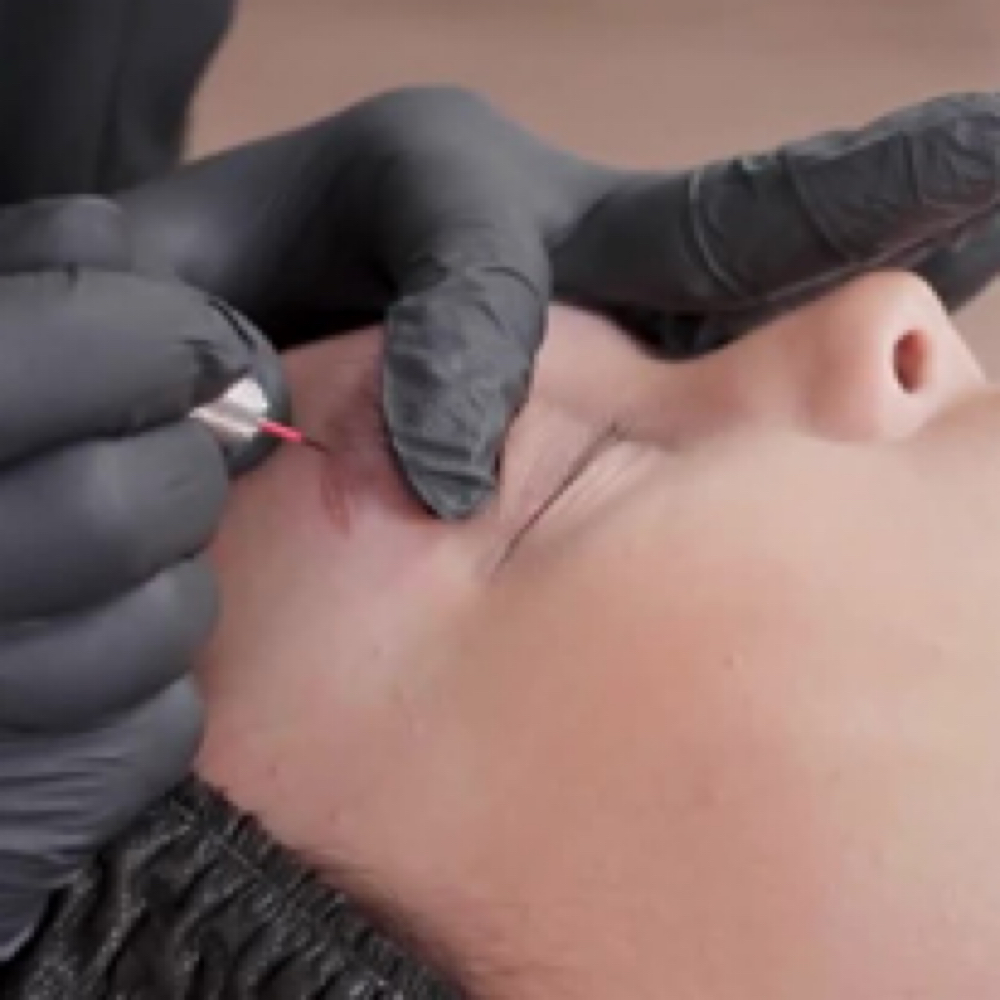 PMU Removal/Correction at Orion Beauty in Cincinnati, OH