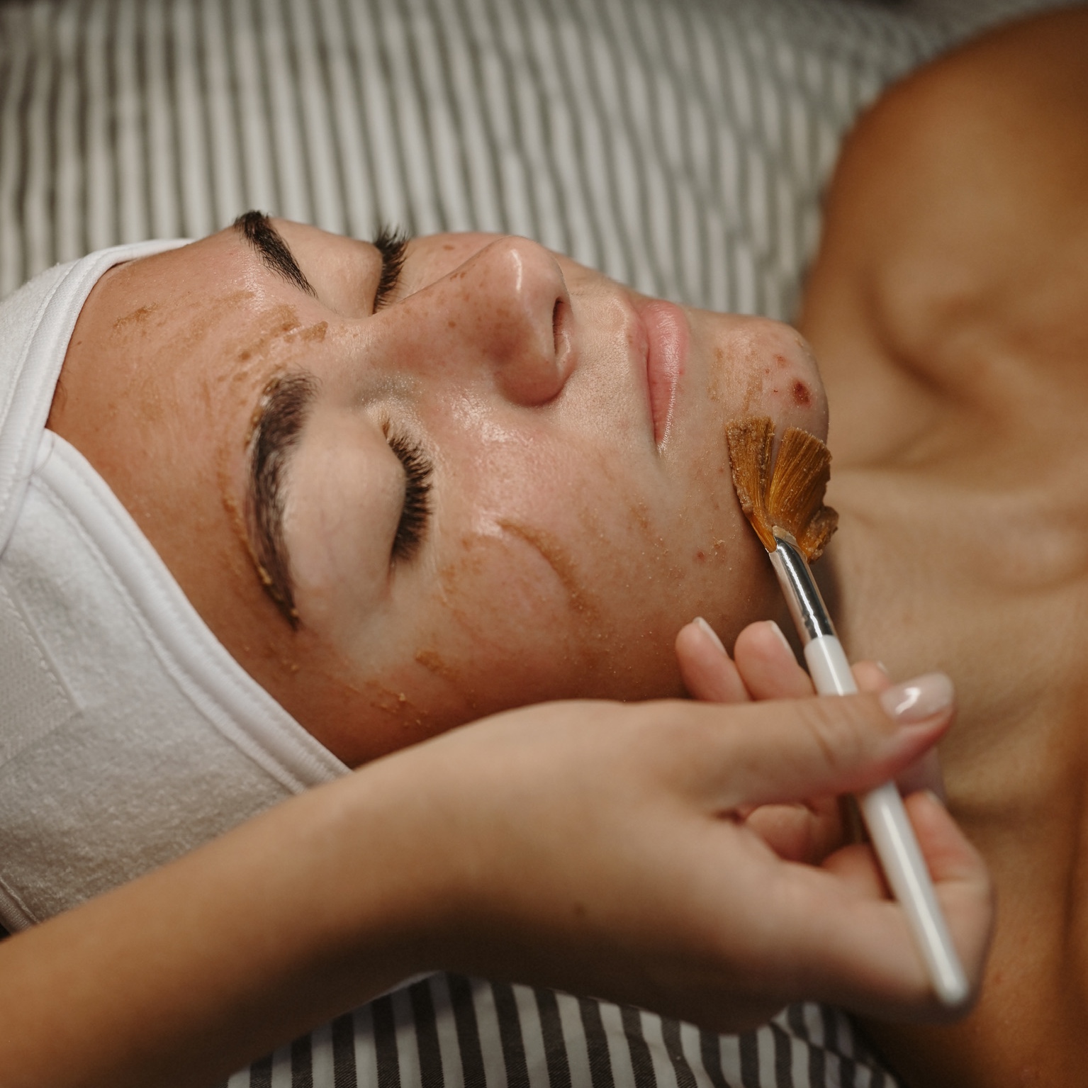 Chemical Peel at Safi Esthetics in Minneapolis, MN
