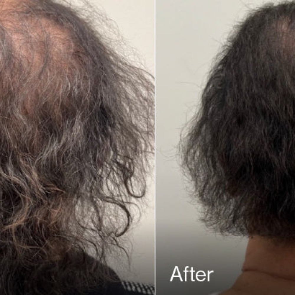 ⭐️Essential Hair Restoration ⭐️ at The Glow Studio in Sioux Falls, SD