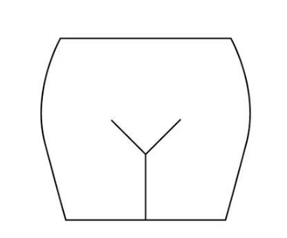 Electrolysis - 45 BRA Surcharge