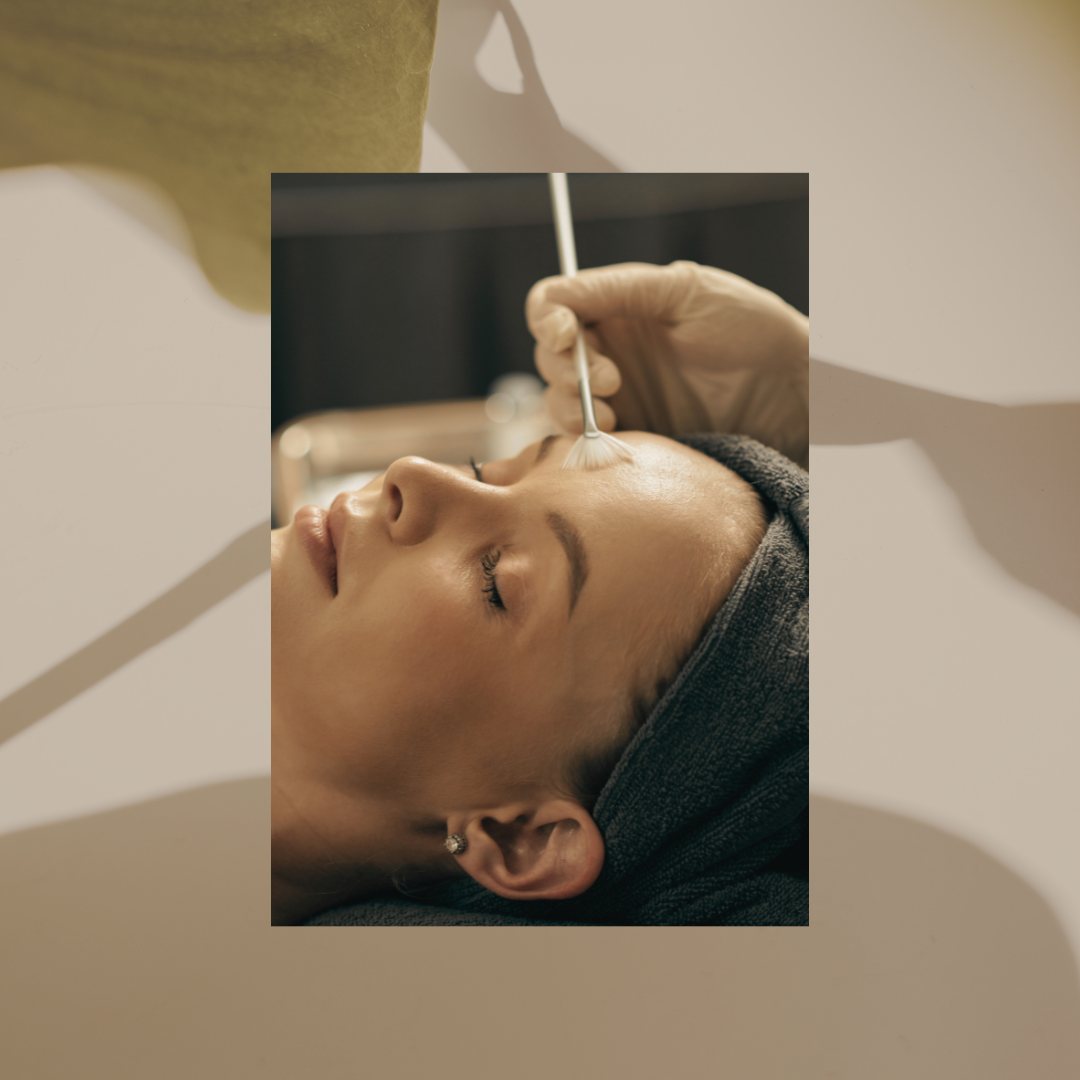 Chemical Peel Consultation