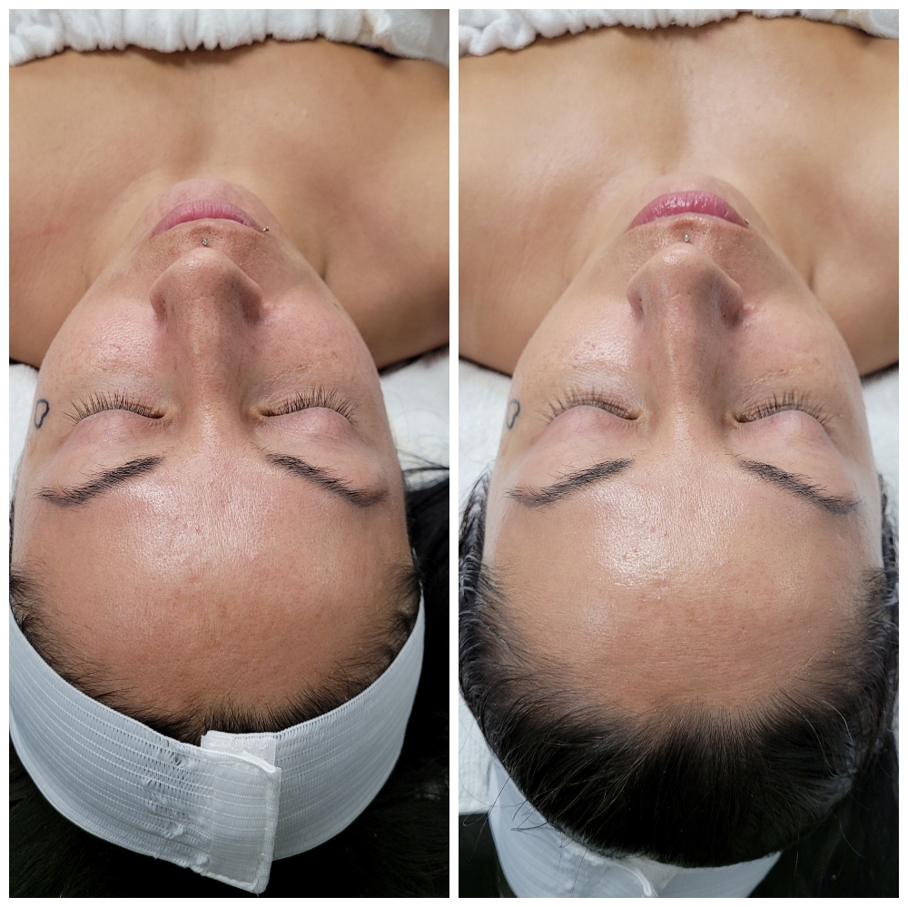 Classic Facial W/skin Analysis