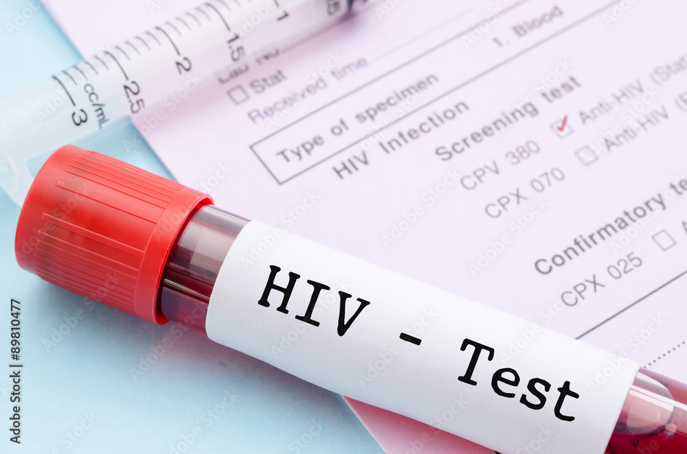 HIV 5th Generation