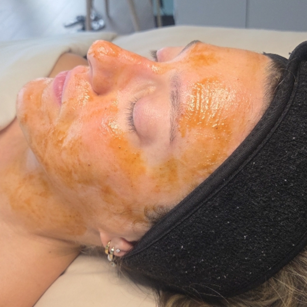 Pumpkin Resurfacing Facial at Skin Sanctuary in San Jose, CA