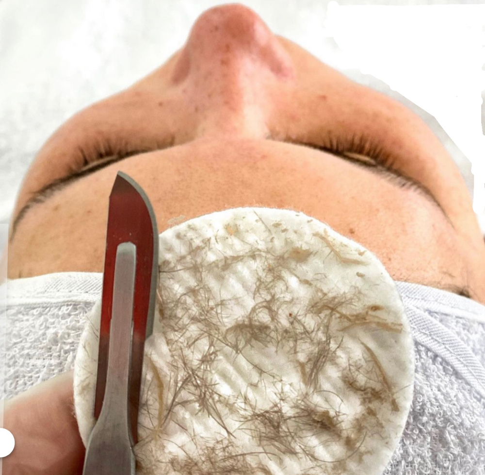 Dermaplane Facial