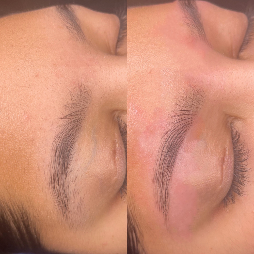 Brows