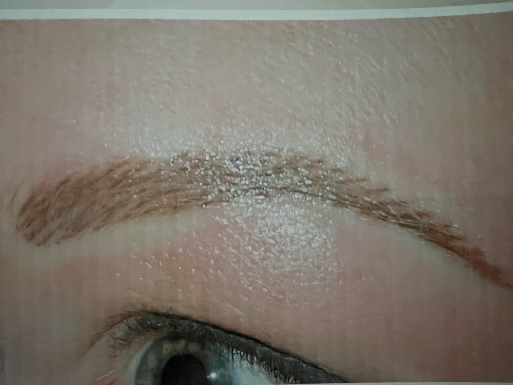 Eyebrow Enhancement