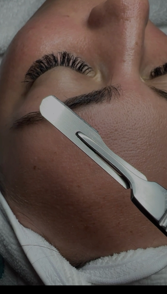 Dermaplane Add On