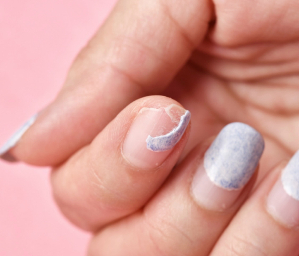 Nail Repair