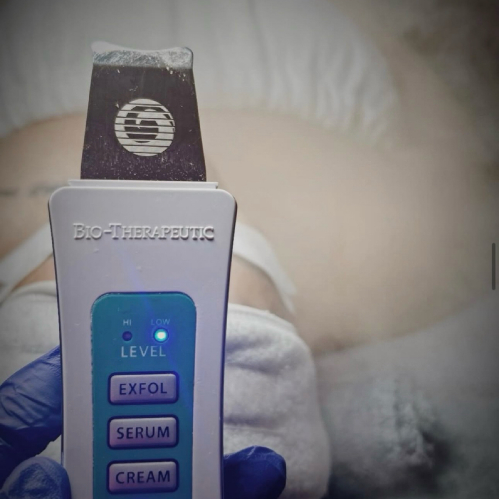 The BT-Micro Facial at TresChic Beauty Lounge in San Diego, CA