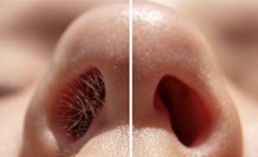 Nose Wax