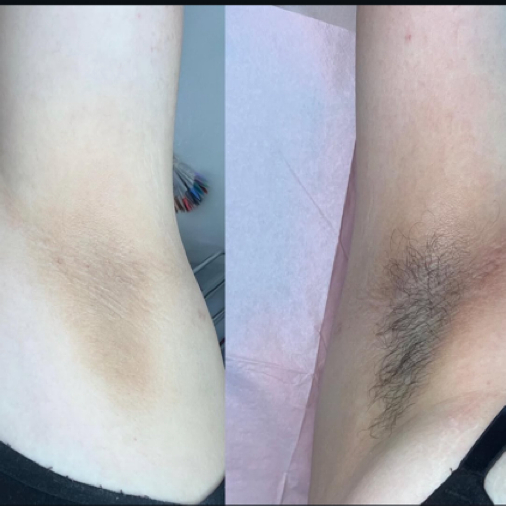 Armpit Wax at So Esthetics in Tucson, AZ