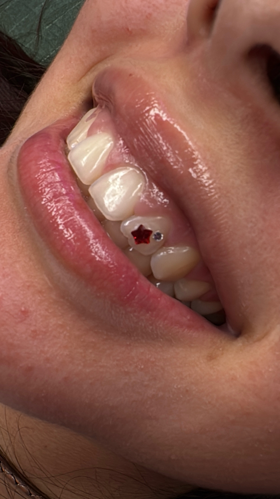 Double Tooth Gem