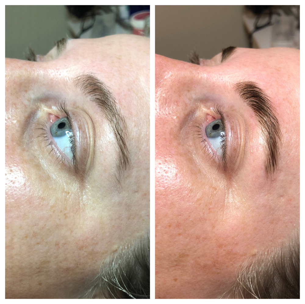 Brow Lamination