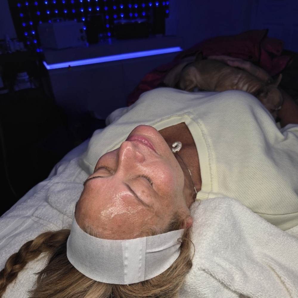 Chemical Peel at LexGlo Esthetics in Idaho Falls, ID