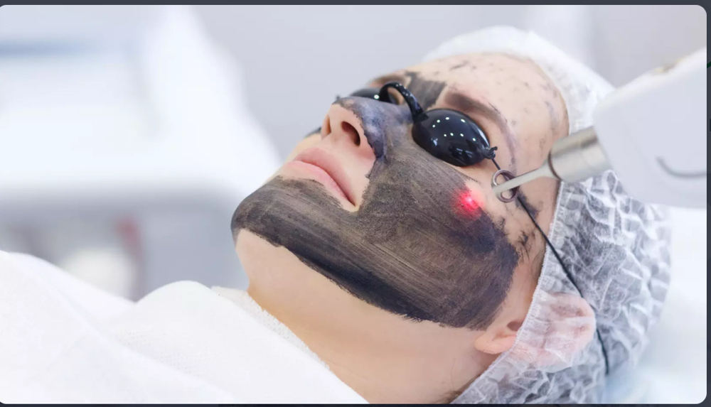 Hollywood Peel Facial