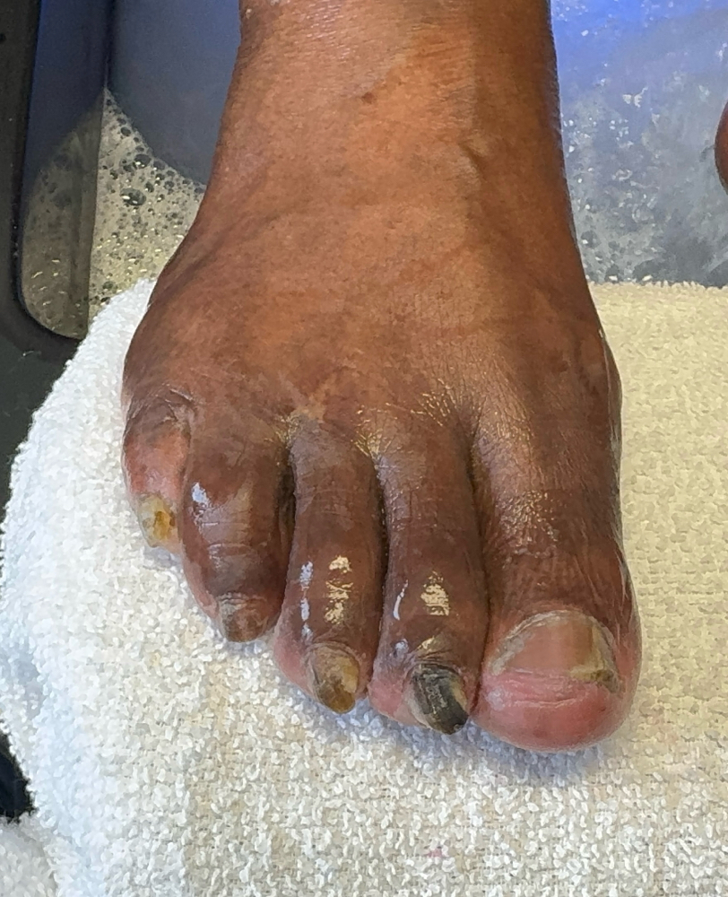 Un-Confident Feet Pedicre