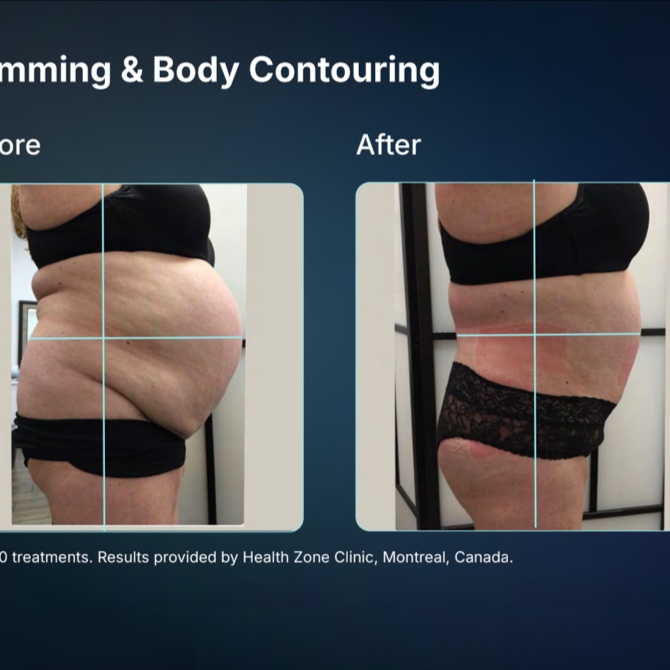 VIP Italia Combo For slimming