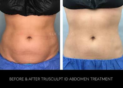 Balance Belly contour packages