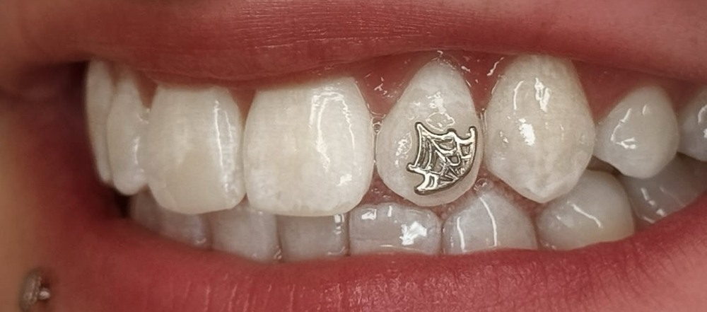 Tooth Gem Application- Gold Gems