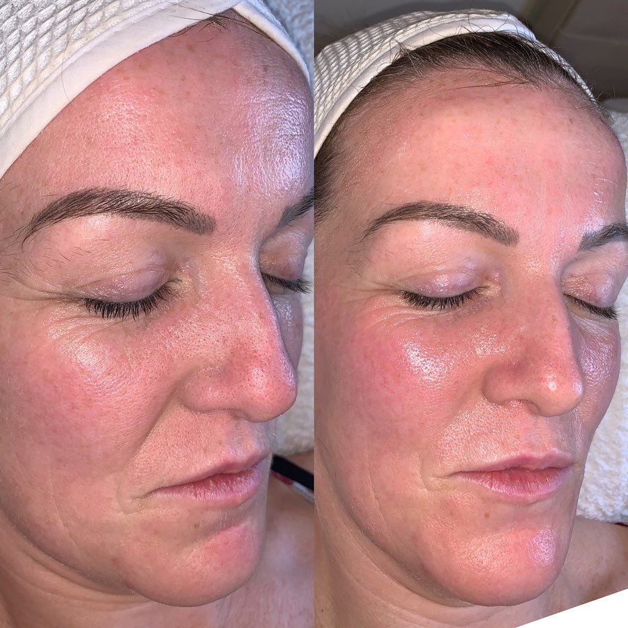 Anti-Aging Facial (1hr)