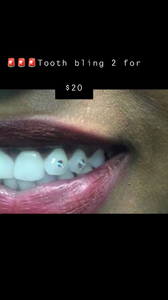 Tooth Bling