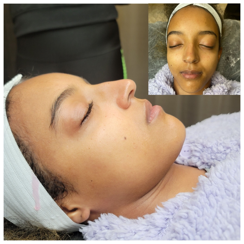 Dermaplaning Facial