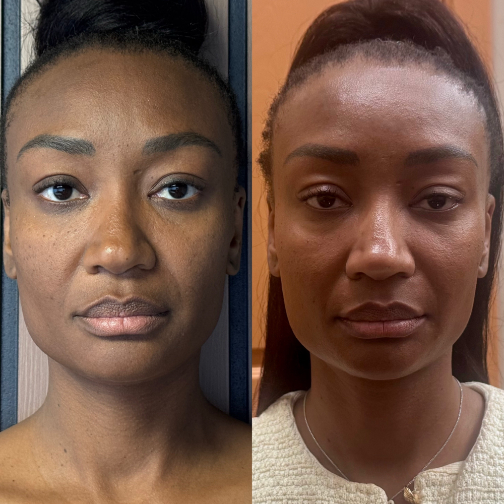 Connecticut $1400 MN SERIES at Corrective Skin & Beauty Ink in Belleview, FL