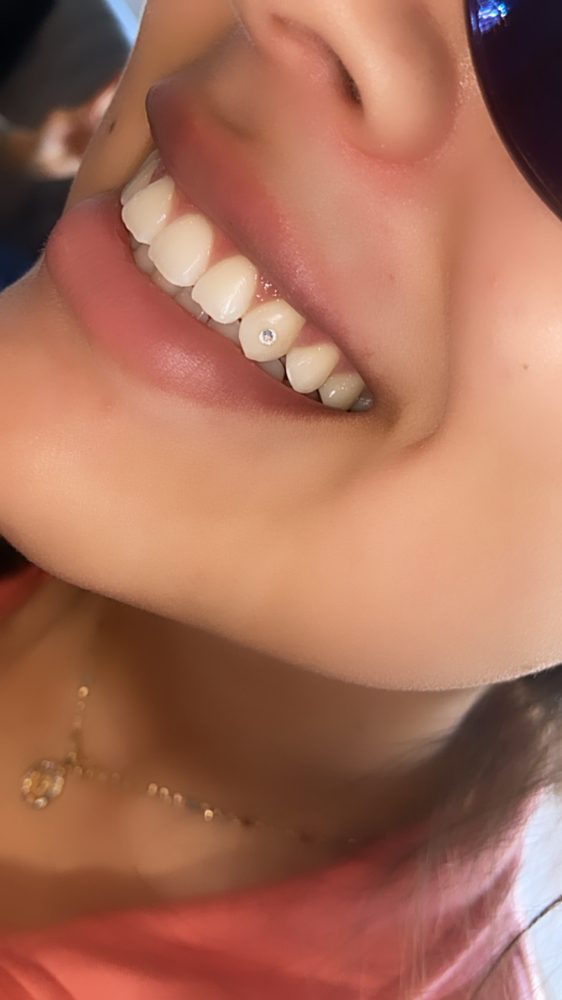 1 Swarvoski Tooth Gem at Candilashes in Glendale, AZ