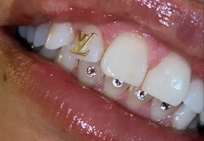 4 Swarvoski Tooth Gems at Candilashes in Glendale, AZ