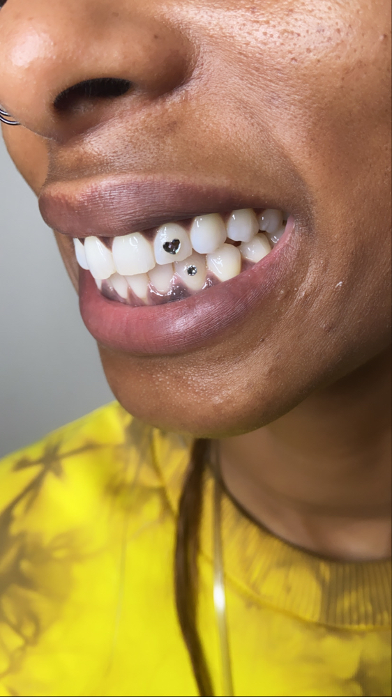 Heart/Shapes Tooth Gem Design at Candilashes in Glendale, AZ