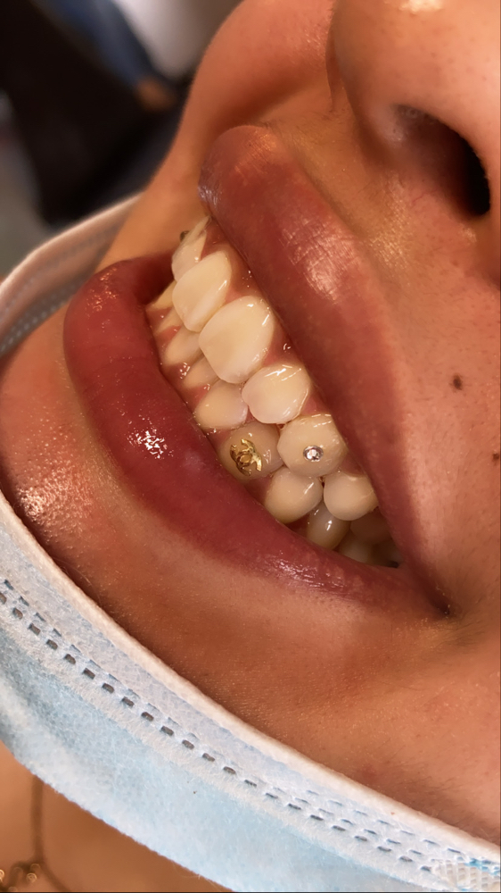 18k Gold/Silver Plates Tooth Gem at Candilashes in Glendale, AZ