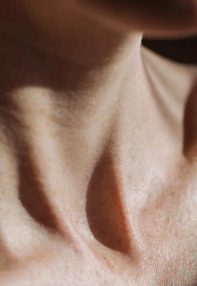 Microneedling (NECK)