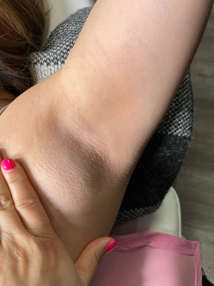 Under Arm
