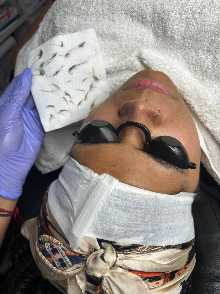 Dermaplane Face With Mask Only at RoseMarie Aesthetics FL in Lake Alfred, FL